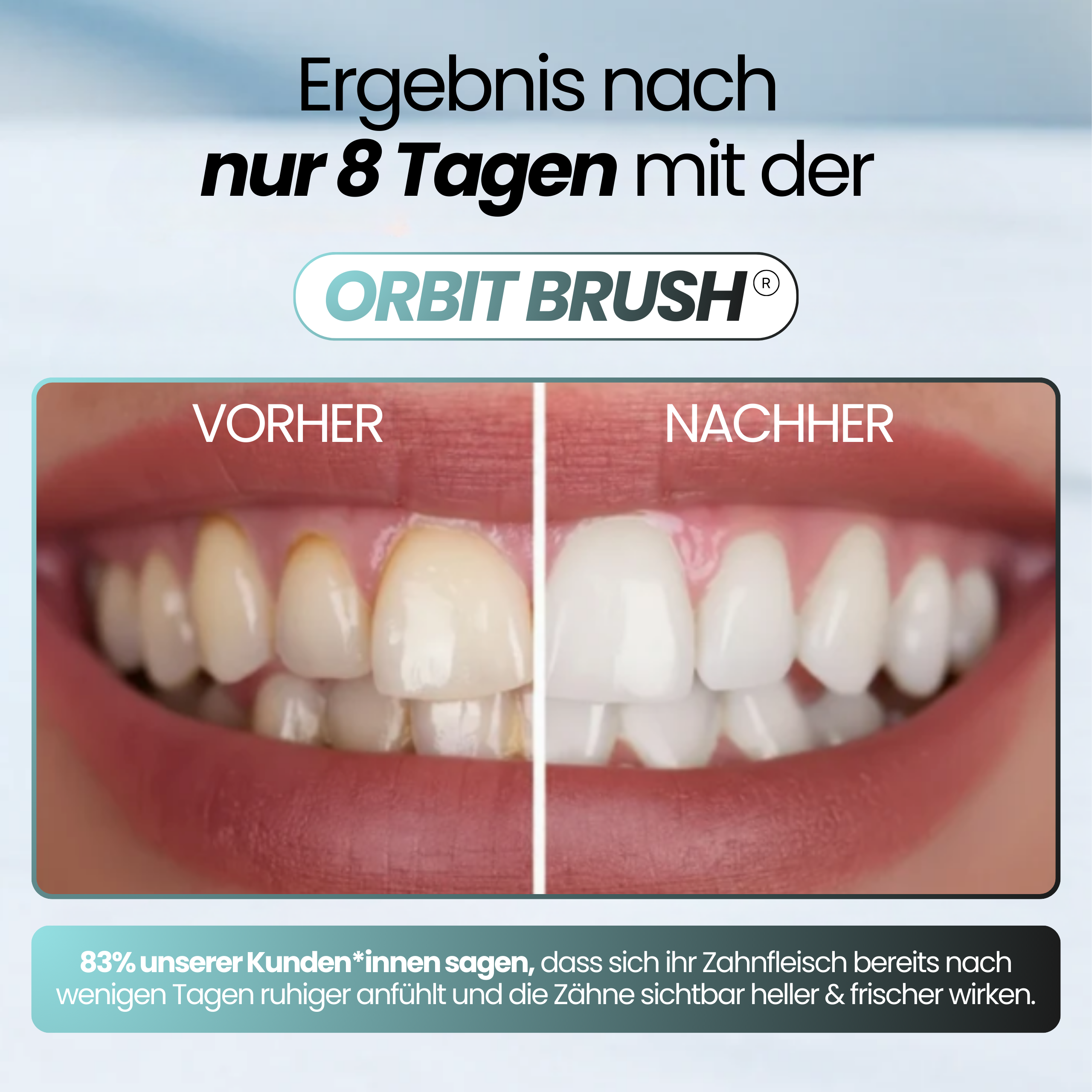 ORBIT BRUSH® - 360° Zahnbürste für saubere Zähne – auch wenn du nicht perfekt putzt.